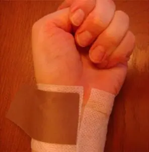 Elbow kinesiology taping physiotherapy