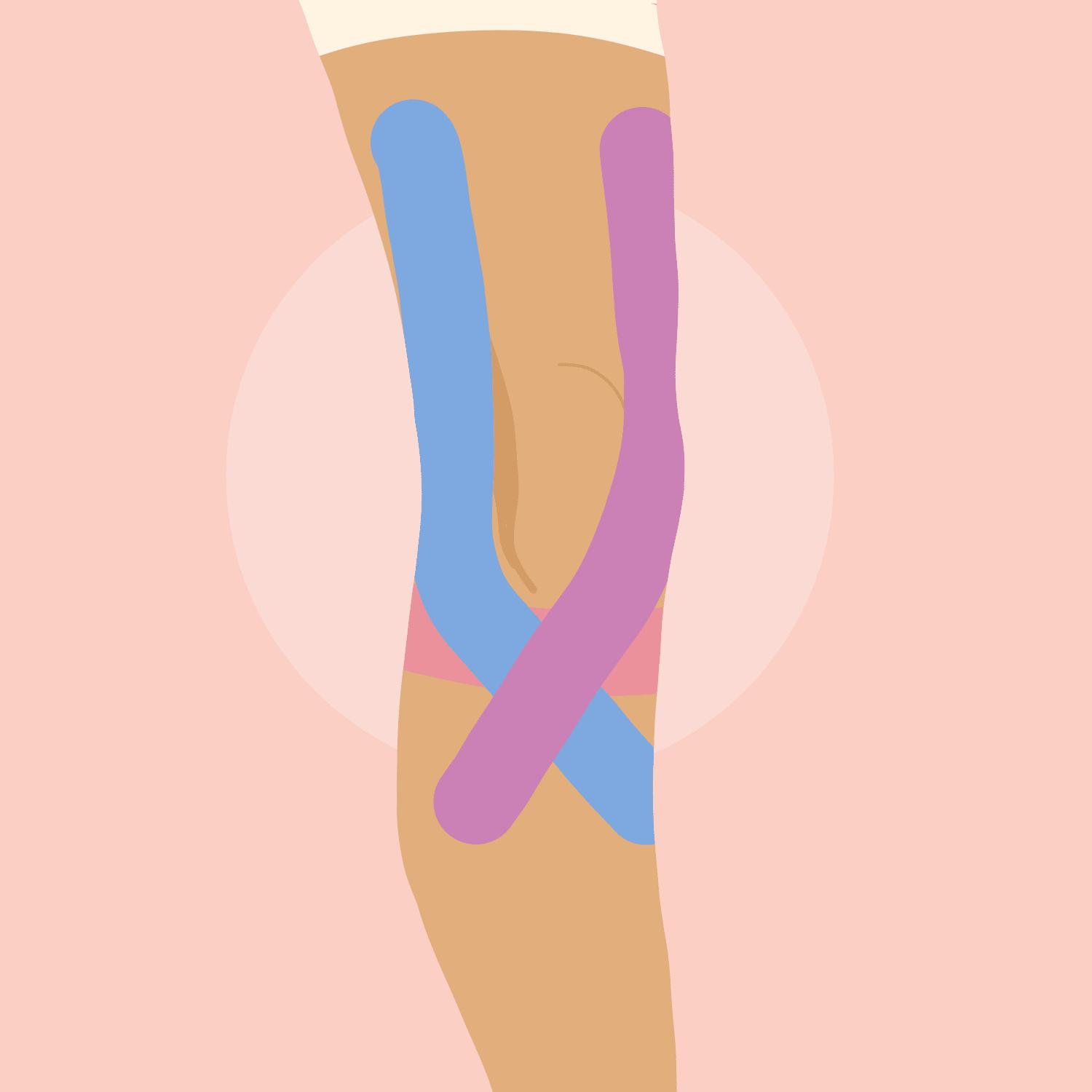 Knee taping physiotherapy treatment