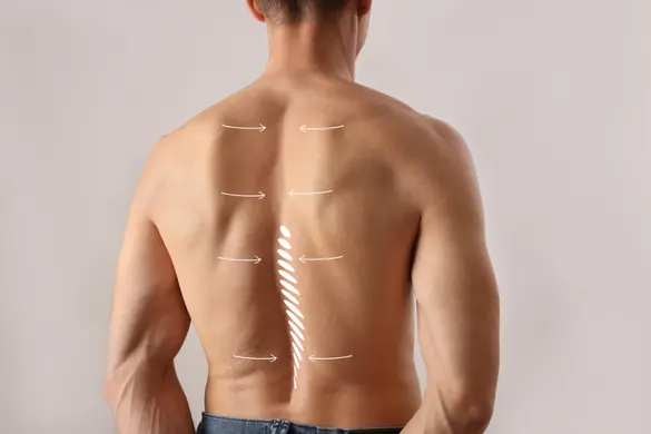 Posture Assessment Exercise